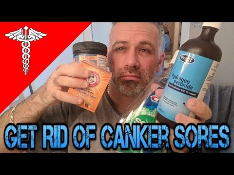 How To Get Rid of Canker Sore PAIN