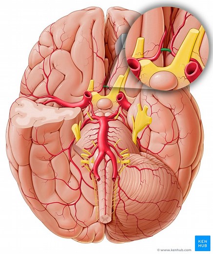Anterior communicating artery