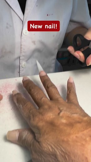 16 reactions · 20 comments | New nail! One of my fingernails broke but the manicurist just glued acrylic nails! #nailsalon #acrylicnails #fbreels #momshiebrends! | Brenda P Ramos | Facebook