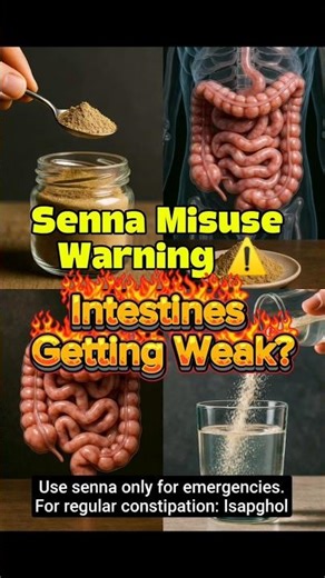 “Senna Warning: Stop Daily Use NOW! | Intestine Damage Explained #senna #constipationrelief
