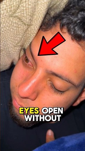 Sleeping With Eyes Open Can Destroy Your Vision!😱
