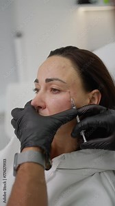 Precise Dermal Filler Procedure for Facial Rejuvenation. Close-up view of cosmetologist carefully administering dermal filler injection to patient's face. Concept Facial Enhancement