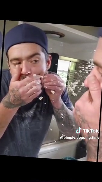 Big pimple pop #pimple #pimplepopper #bigpimple #skincleaning #longervideos #omg #viral