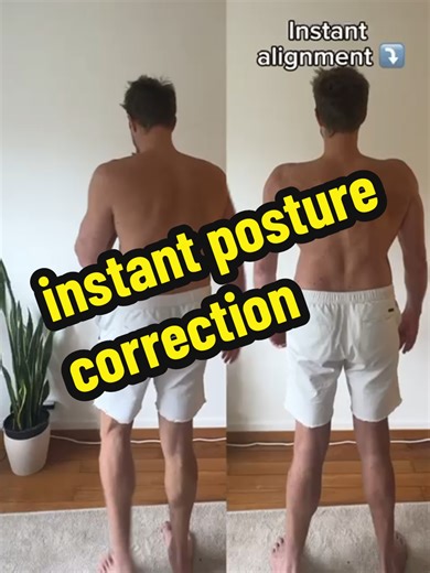 Understanding Kyphosis: Improve Your Body Movement