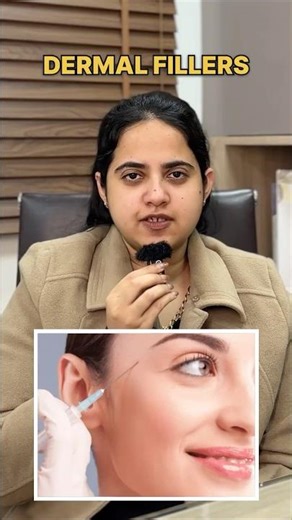 Best Dermal Filler Treatment in Delhi | How Dermal Fillers work? | What are Fillers | Face Fillers