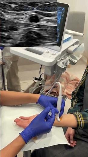 Pain in the first joint of the finger... "Intra-arterial treatment" is an option for Heberden's n...