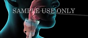 Bronchoscopy | Learning Medicine