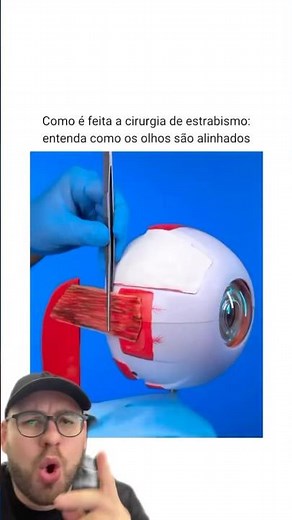 How is strabismus surgery performed?