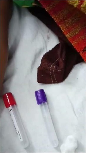 # blood # sampling# procedure # blood investigation # CBC # lft # rft# diagnosis # trending vedios