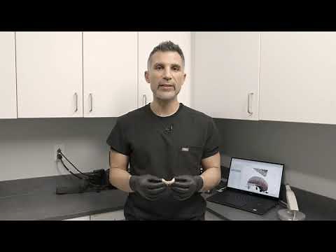 Tips and tricks on using Straumann® RevEX™ workflow with Dr. Panos Papaspyridakos