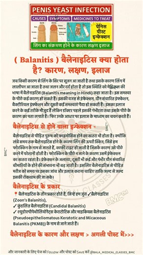 Bala Medical Classes™ ❣️ || बाला मेडिकल क्लासेस™ ❣️ on Instagram: "🔴 (Balanitis) बैलेनाइटिस क्या होता है? कारण | लक्षण | इलाज जब किसी कारण से लिंग के सिर (Glans Penis) पर सूजन, लालिमा, जलन या दर्द हो जाए, तो इस स्थिति को मेडिकल भाषा में बैलेनाइटिस (Balanitis) कहा जाता है। यह समस्या इन्फेक्शन, एलर्जी, गंदगी या डायबिटीज के कारण हो सकती है। 🔹 बैलेनाइटिस से होने वाला खतरा बैलेनाइटिस से पीड़ित पुरुषों में फिमोसिस (चमड़ी का पीछे न जाना) का खतरा बढ़ जाता है। लंबे समय तक इलाज न मिलने पर इन्फेक्शन गंभी