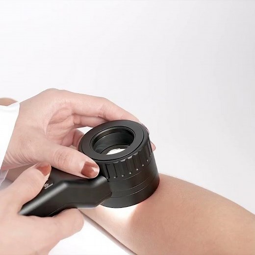 DE 4100 dermatoscope #dermatology #dermoscopy