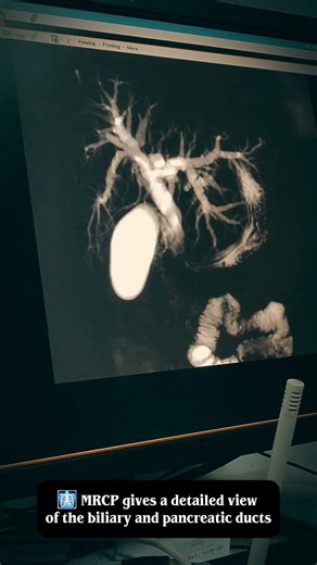 🩻 MRCP Scan Explained | Bile Duct & Pancreatic Duct MRI