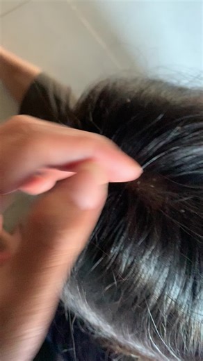 Effective Lice Removal Strategies for Parents