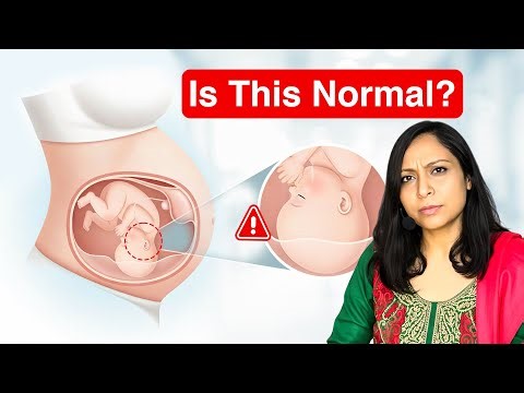 ⁠Third Trimester Baby Positioning Explained | Head Down, Engaged & Ready for Birth