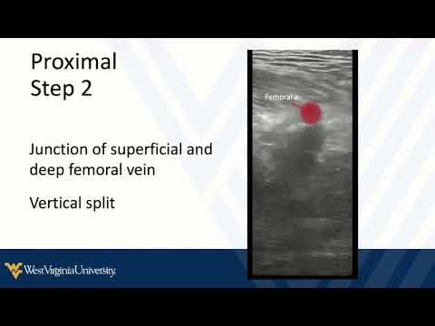 DVT POCUS 2 - Scan Technique and Anatomy