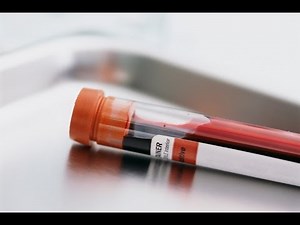 Fasting for Blood Work | Frequently Asked Questions