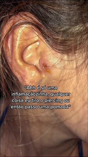 Understanding Ear Irritation and Inflammation Symptoms