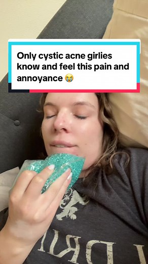 I love having my entire chin swell for one cyst it is so slay #fyp #foryoupage #cysticacne #cysticacneproblems #acneproneskin #warmcompress #hydrocolloidbandages #imjustagirl #imjustagirlintheworld