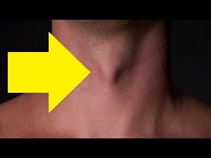 how to get a bigger adam's apple naturally at home easy
