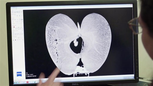 101 reactions · 4 comments | Extremely versatile ZEISS Xradia Versa...