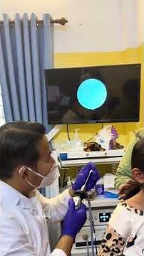 😱 Giant Earwax Removal You Have to See! #earwaxremoval #earcleaning #shorts