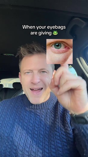 Say Goodbye to Puffy Eyes with Lymphatic Drainage Massage