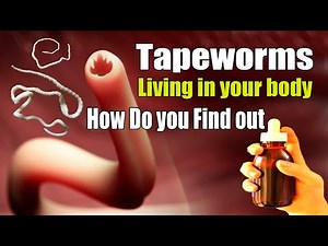 Signs that you have tapeworms living in your body! how do you find out? Means of treatment & prevent