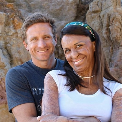 26K views · 164 reactions | "Unwavering devotion!” ❤️After a fire damaged his wife’s beauty, the husband refused to leave her. Despite the changes to her appearance, he never wavered in his love and commitment.‍❤️‍But what did she look like before the tragic fire. Scroll down to the top comment to see her past photos and share your thoughts on their inspiring relationship! ⬇️⬇️⬇️ | Fun Day | Facebook