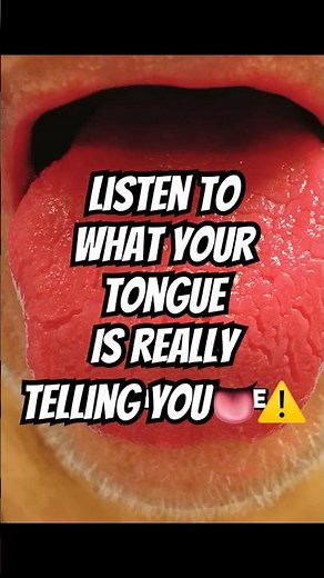 What Your Tongue Says About Your Health (It’s More Than You Think)