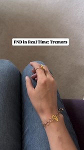 2.3K views · 49 reactions | Sometimes my hand starts to tremble uncontrollably ✋ #FND #functionalneurologicaldisorder #functionalneurologicalsymptoms #fndawareness #fndwarrior #fndaware #fblifestyle | Functional Neurological Disorder/ FND Hope International | Facebook