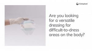 Do you also manage wounds in difficult-to-dress areas of the body? We have a solution for you with Biatain Silicone Multishape. Watch the video to discover how its unique designed shapes can help you dress wounds for a variety of body parts. #biatainsilicone #biatainsiliconemultishape #difficultodressareas #wounddressing #coloplast #coloplastwound | Coloplast Wound and Skin Care