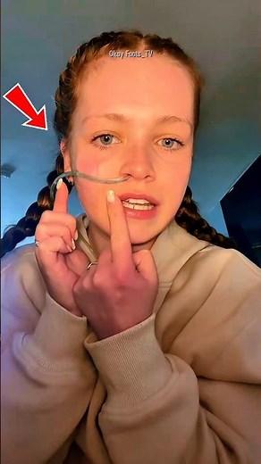 Why Do Patients Have a Tube in Their Nose? Here’s What It’s Actually For❗ 😳 #shorts