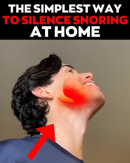  Top Rated Anti-Snoring Mouthpiece 喙 Proven Effectiveness: Feliora...