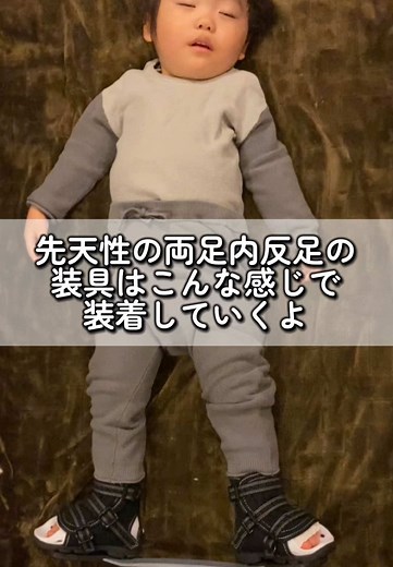 先天性内反足の装具の装着法