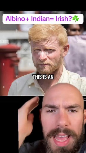 Albino Indians Look Irish ☘️ #albino #irish #indian | The Life Professor Clips