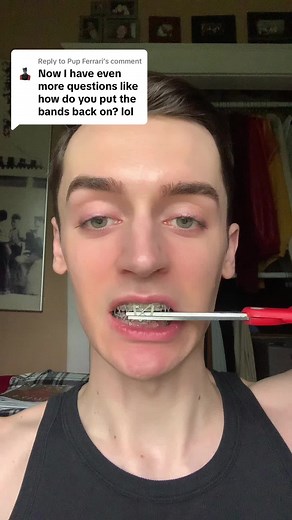 How to Properly Put Back Braces Bands: Step-by-Step Tutorial