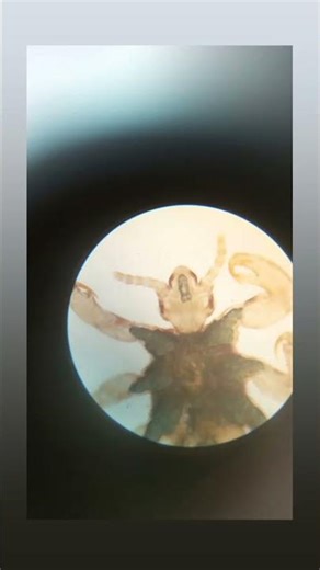 Microscopic world🔬➡️The head louse & its powerful claws Method of slide preparation in description➡️