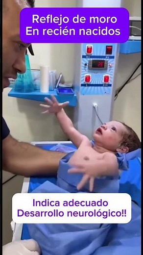 Reflejo de moro en recién nacidos!! # #pediatria #bebes #niños