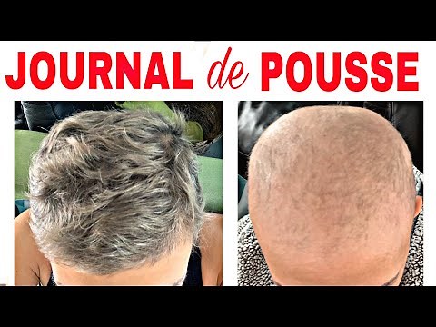 POUSSE DE CHEVEUX + CILS IMPRESSIONNANT (JOURNAL DE POUSE) comment faire pousser ses cheveux