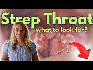 Strep Throat in Kids: Symptoms, Treatment, & What Parents Need to Know