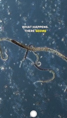 Testing ParaGuard: Parasite Cleanse Results Under the Microscope