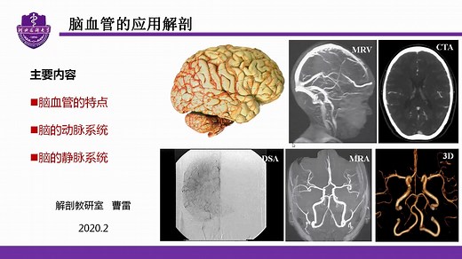 脑血管的应用解剖