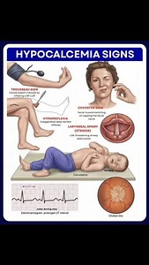Signs of hypoglycemia #studygram #medical #hypoglycaemia #bloodsugar #nursing | Nursing Simplified | Facebook
