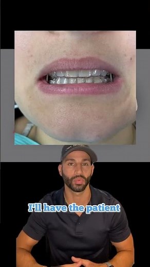 How Invisalign Works: A Case Review. 2023