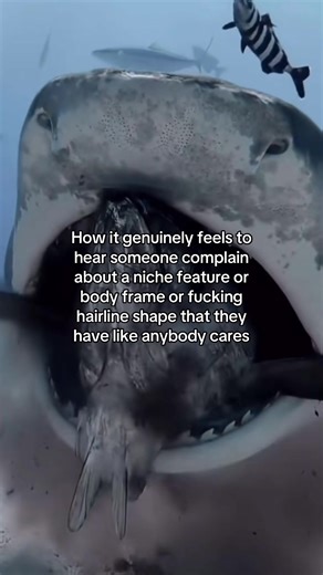 Embracing Unique Features: Vampire Eyes and More