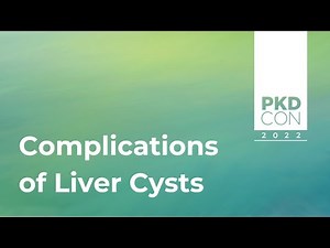Complications of Liver Cysts