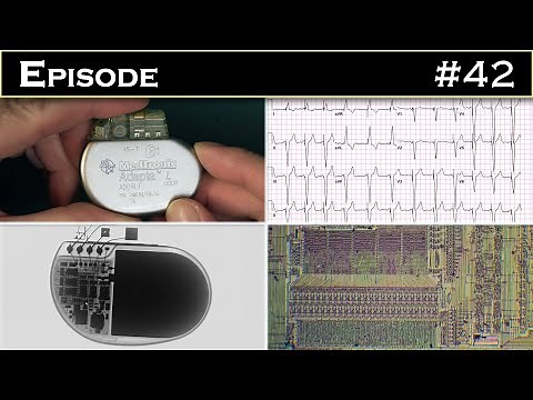 Stimulateur cardiaque : Anatomie d'un petit boitier qui sauve des vies humaines