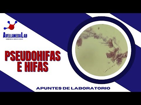 ¿COMO SE VEN LAS PSEHUDOHIFAS E HIFAS EN UNA MUESTRA DE ORINA?
