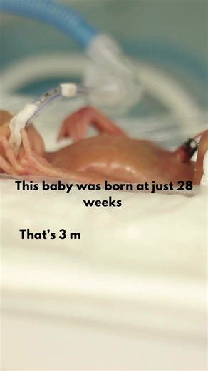 Caring for Premature Babies: A Journey in the NICU